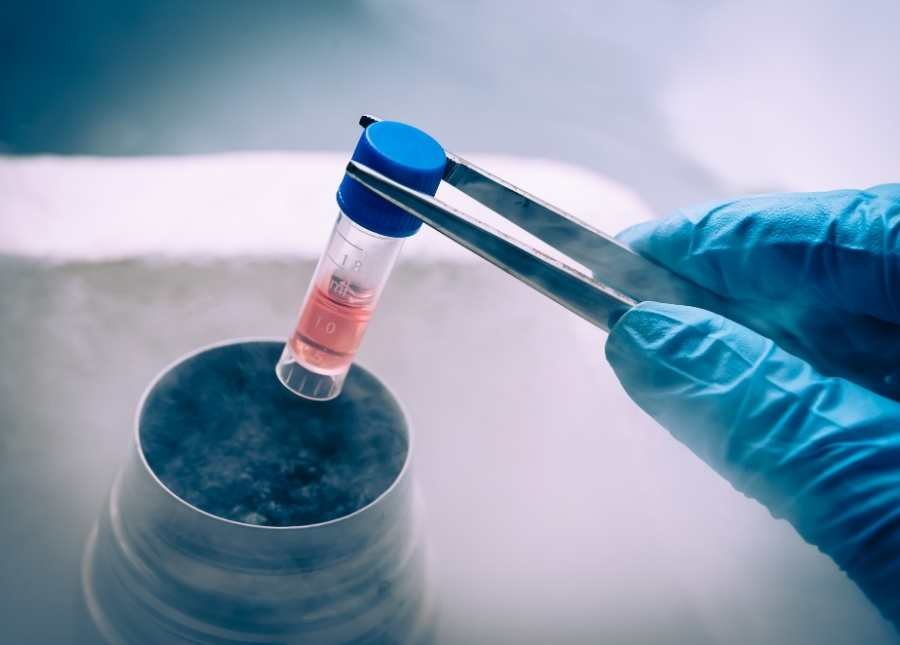 Plasma Rico en Plaquetas (PRP)