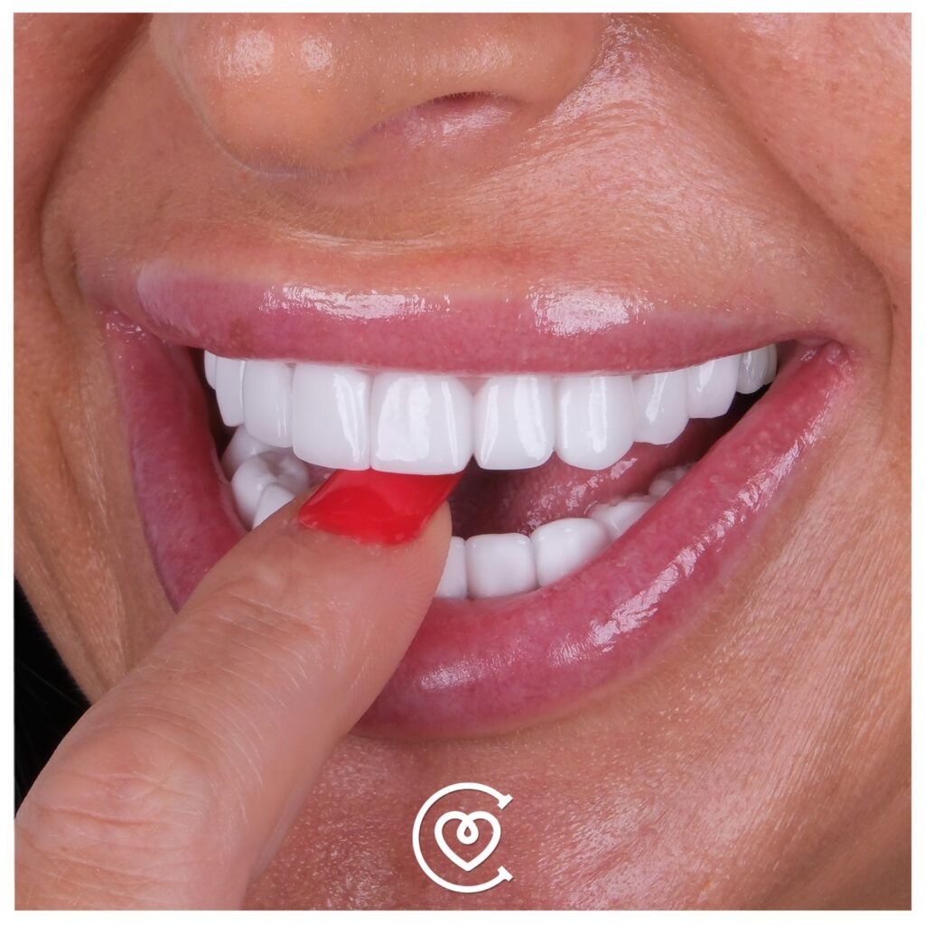 Carillas Dentales en Turquía
