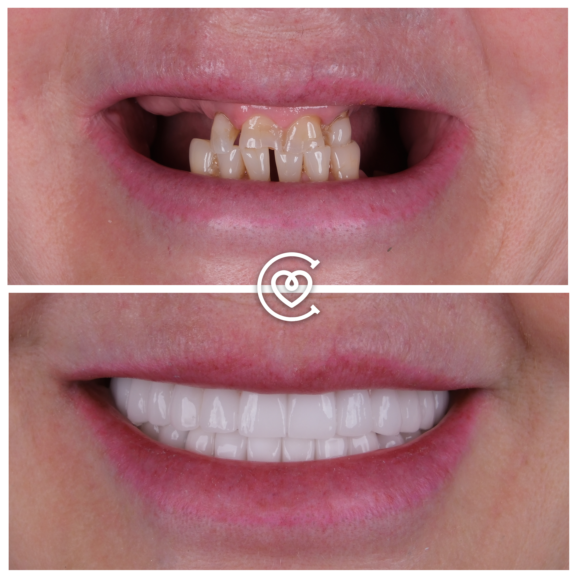 Testimonios de pacientes sobre tratamientos dentales
