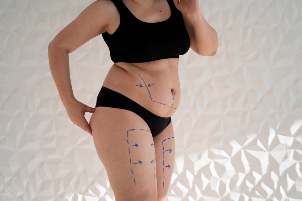 recuperación de una liposucción