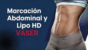 Marcación Abdominal y Lipo HD