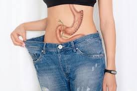 Plicatura Gástrica en Turquía