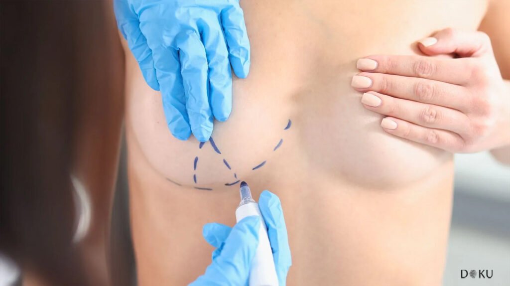 mastopexia sin implantes en Turquía