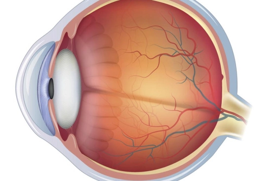 desprendimiento de retina en Turquía