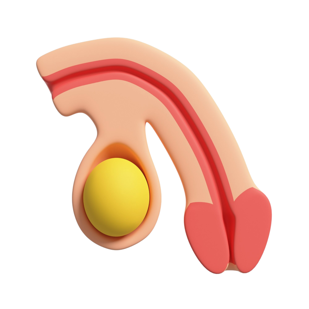 Faloplastia Resultados