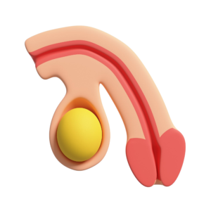 Faloplastia Resultados