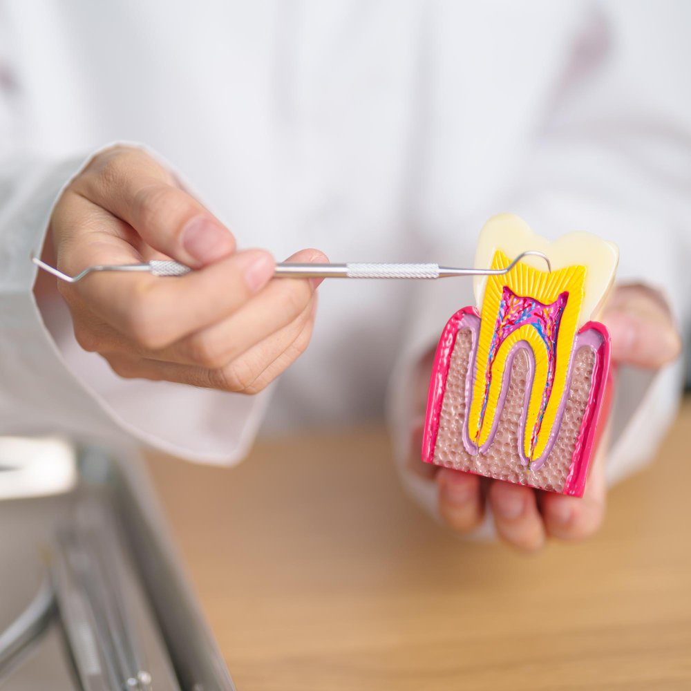 Endodoncia Avanzada