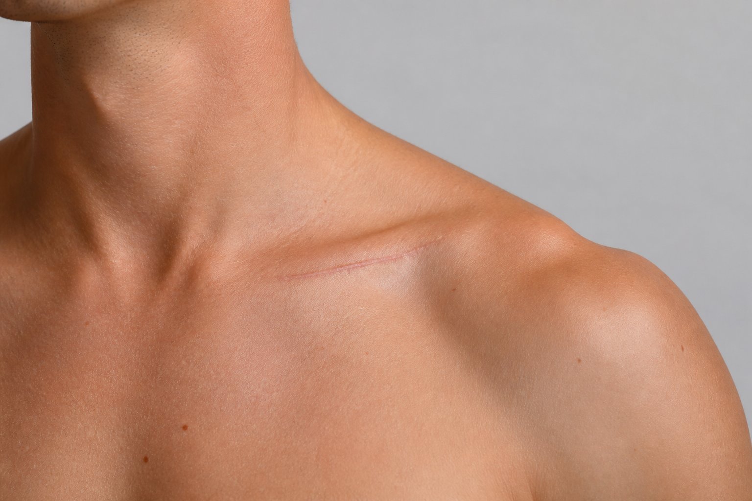 Primer plano del área del hombro y clavícula con una cicatriz visible pero bien curada.
