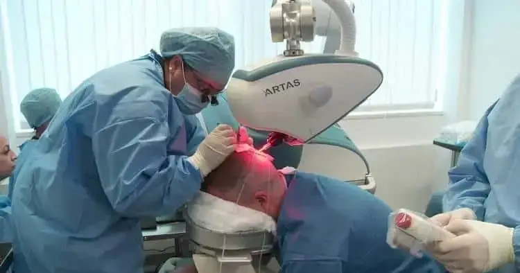 Trasplante capilar robotizado que ofrece resultados naturales y precisos