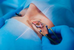 Cirugia endoscopica de conducto lagrimal DCR en Turquia Cayra Clinic