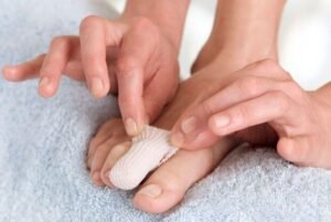 Cirugia definitiva de una encarnada y matricectomia en Turquia Cayra Clinic