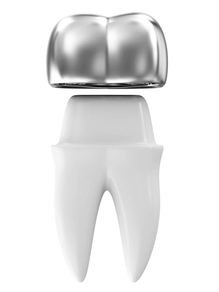 Coronas dentales de zirconio en Turquía para una sonrisa estética y natural.