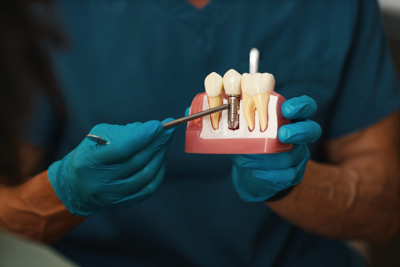 Diseno de sonrisa Hollywood Smile con coronas de zirconio y carillas en Turquia