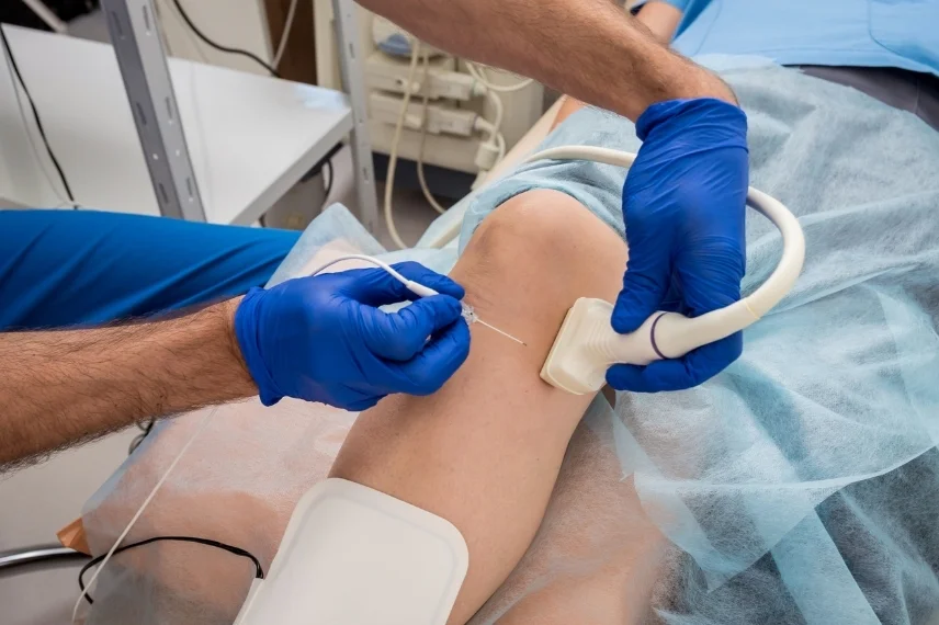 Ecografia Doppler color y mapeo venoso de varices en Cayra Clinic