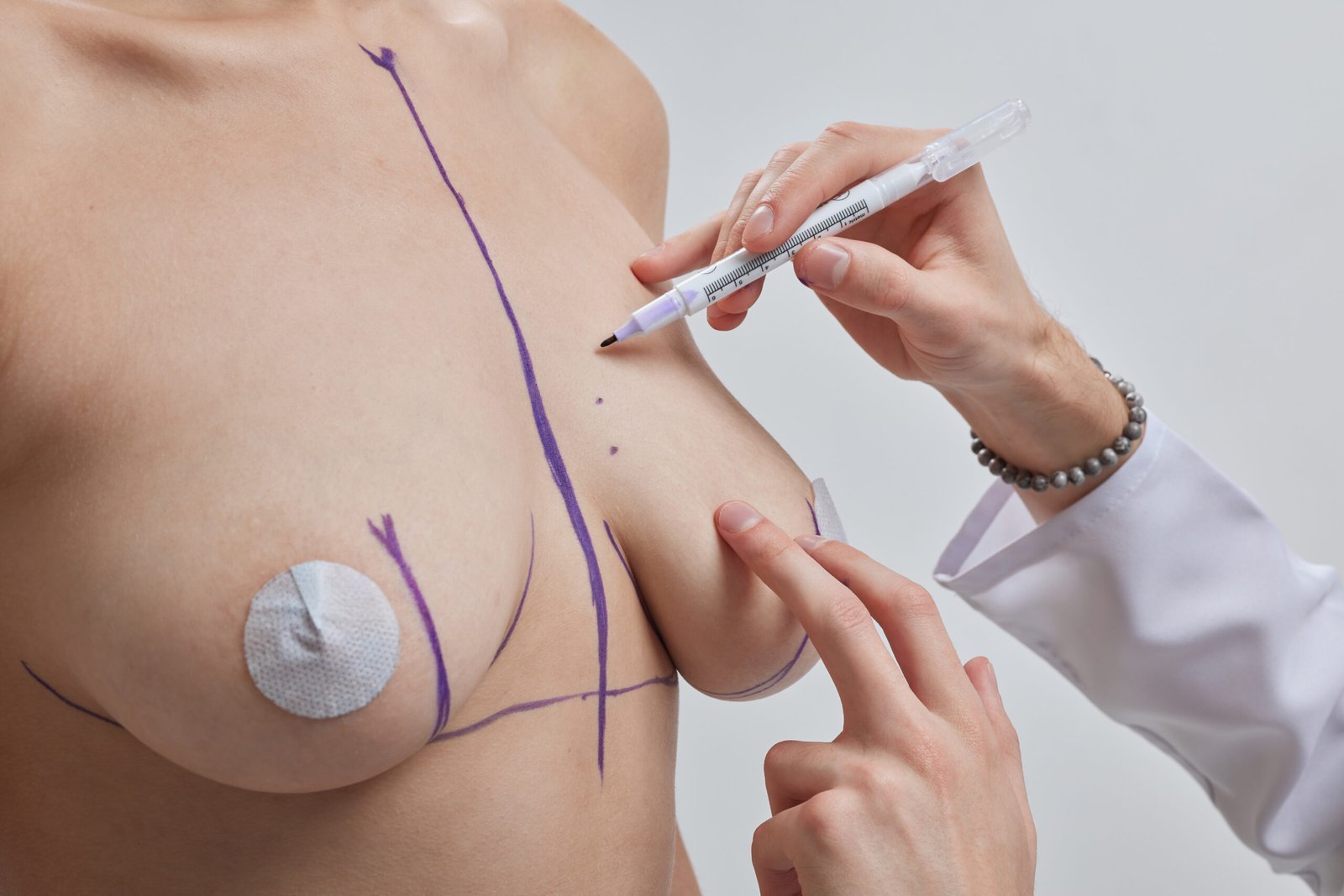 Elevación de senos mastopexia para remodelar el pecho caído en Cayra Clinic