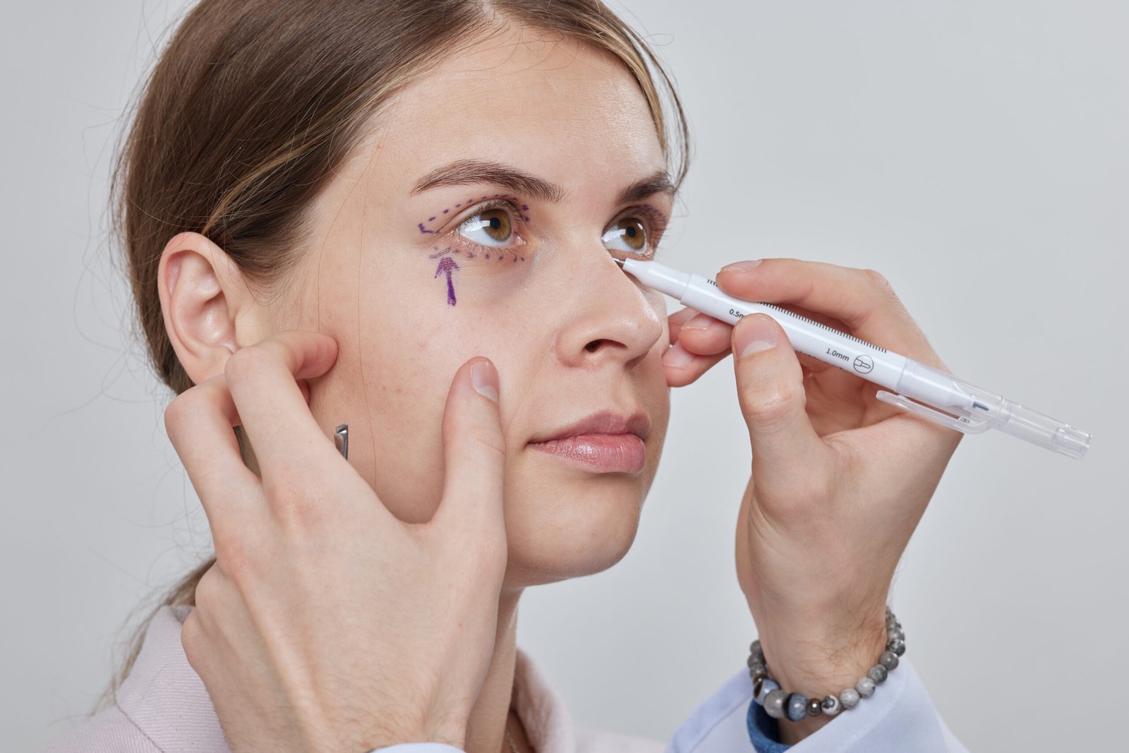 Etapes de cicatrisation et guerison apres blepharoplastie a Istanbul