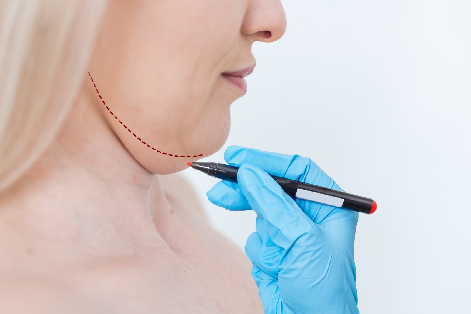 Quirofano acreditado por JCI para liposuccion submentoniana en Cayra Clinic