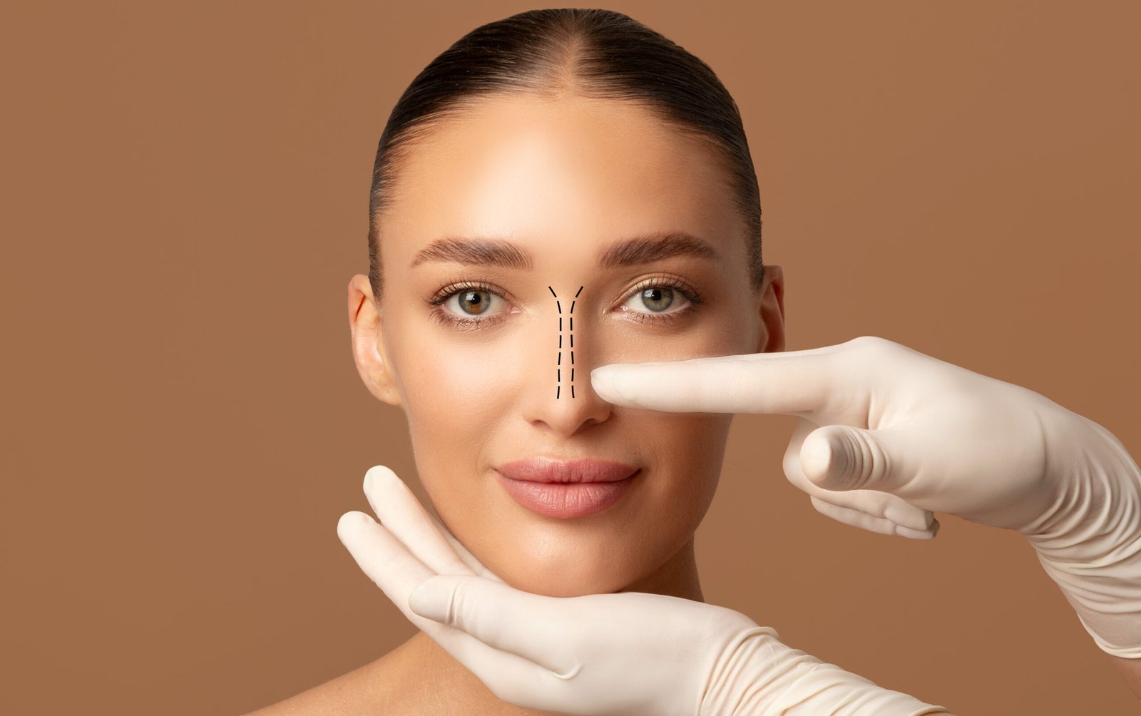 Comparativa de tecnicas rinoplastia abierta vs cerrada en Estambul