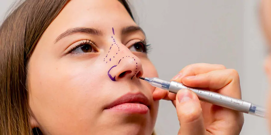 Comparativa de tecnicas rinoplastia ultrasonica vs tradicional en Estambul