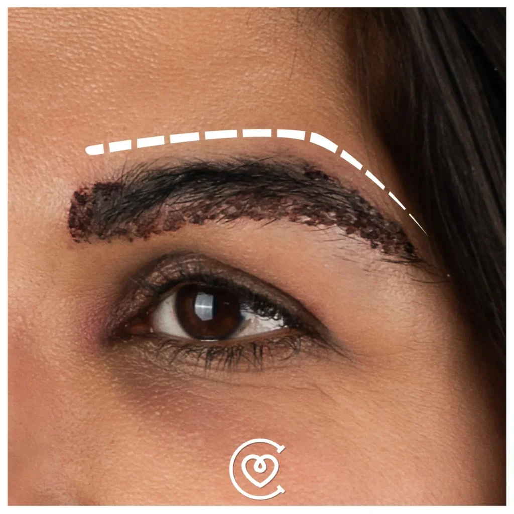 Trasplante de cejas-turquia