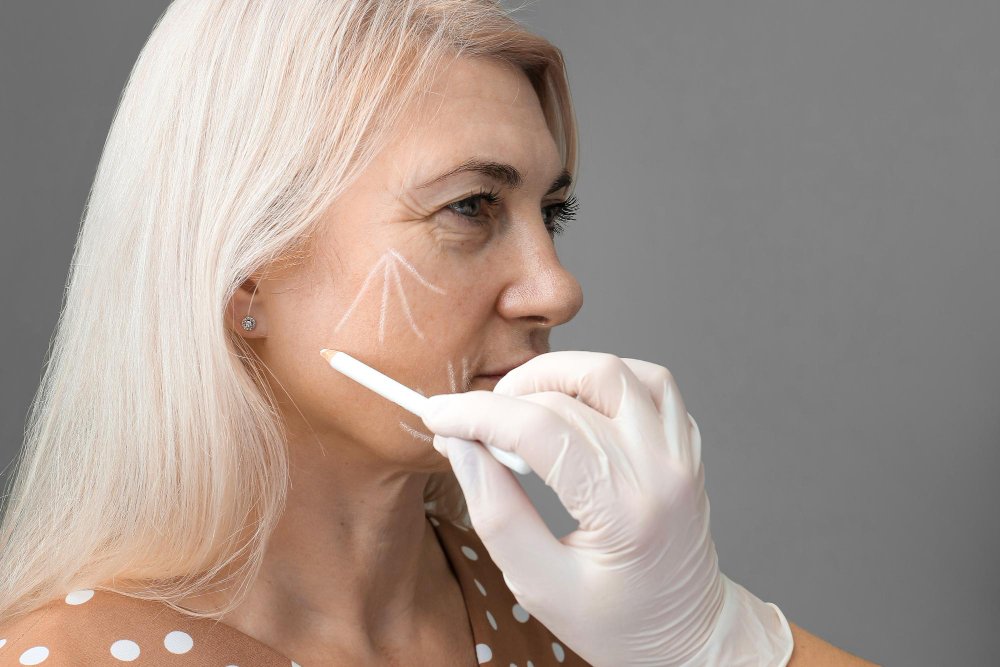 Lifting facial no quirúrgico