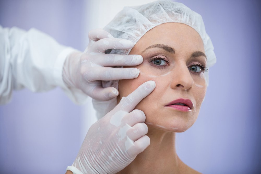 Lifting facial