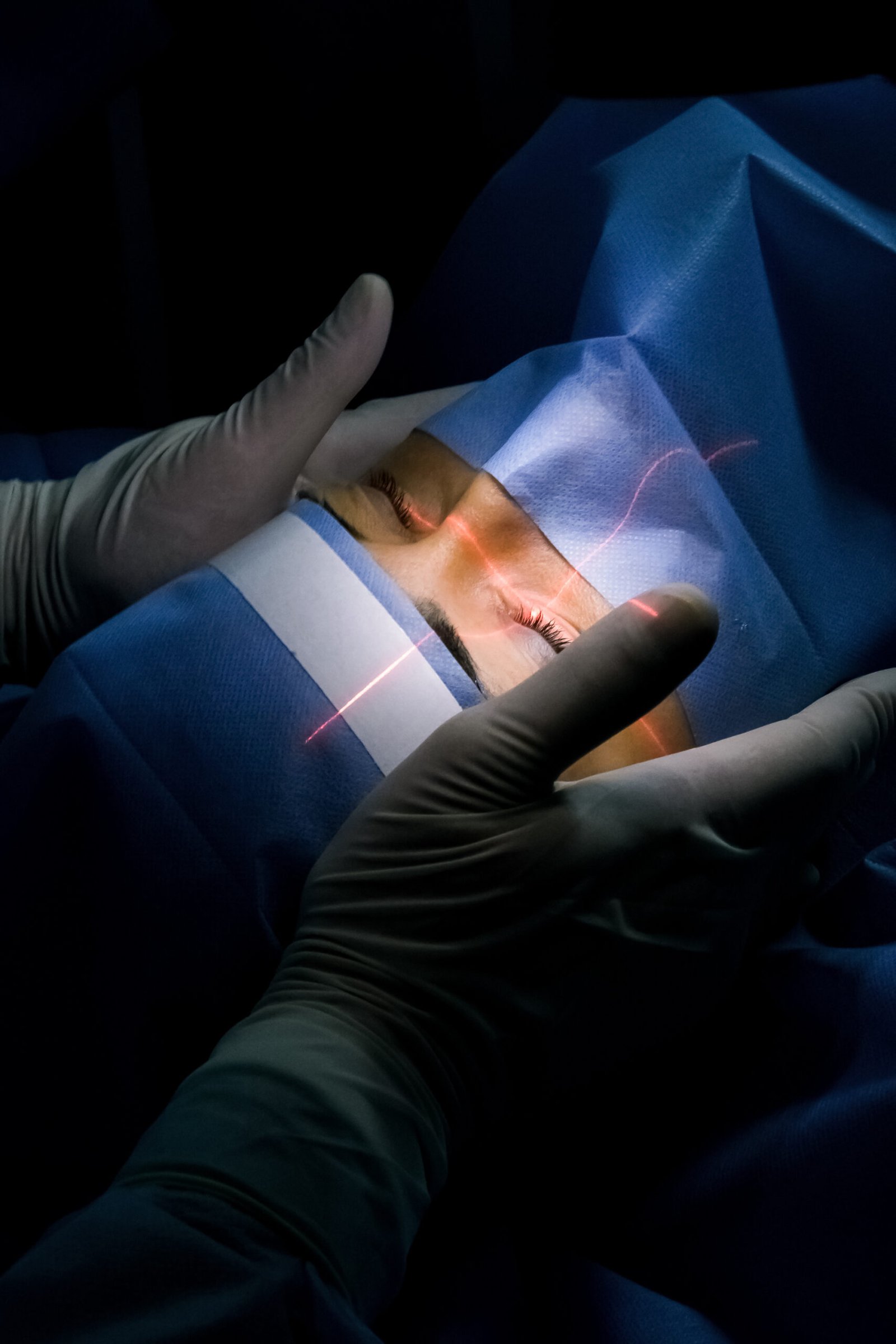 Tecnologia Femto-LASIK para cirugia refractiva ocular en Estambul