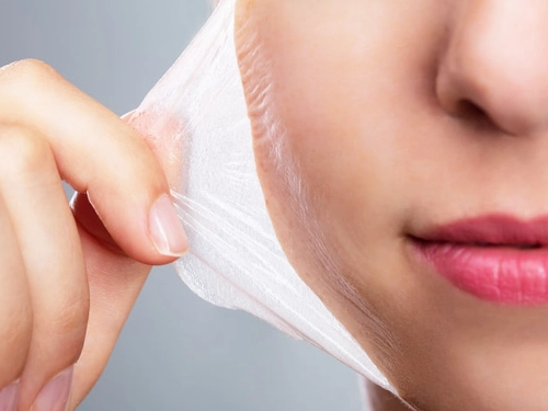 Aplicación de peeling de fenol y TCA para rejuvenecimiento facial en Estambul