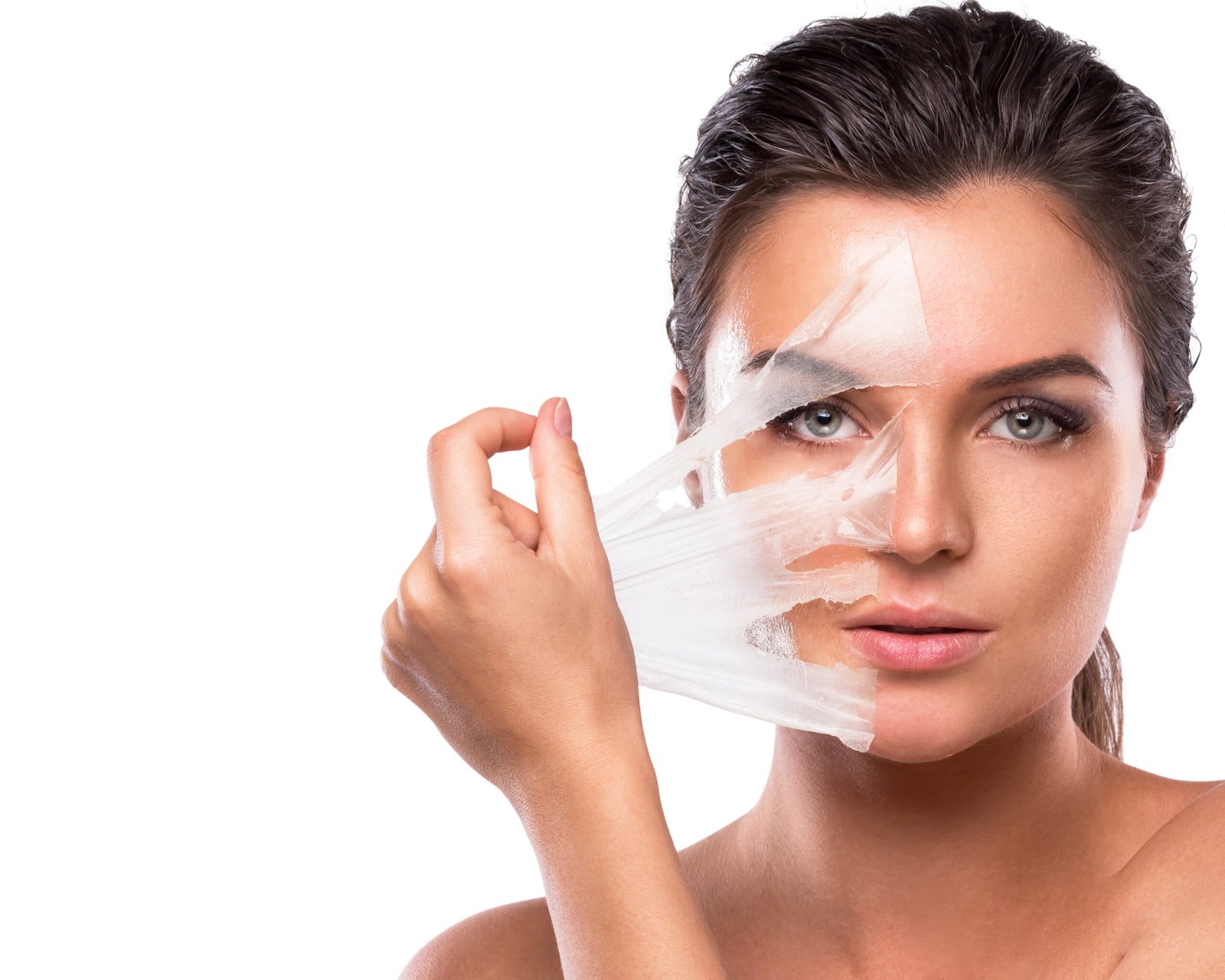 Procedimiento médico de peeling químico profundo en Cayra Clinic