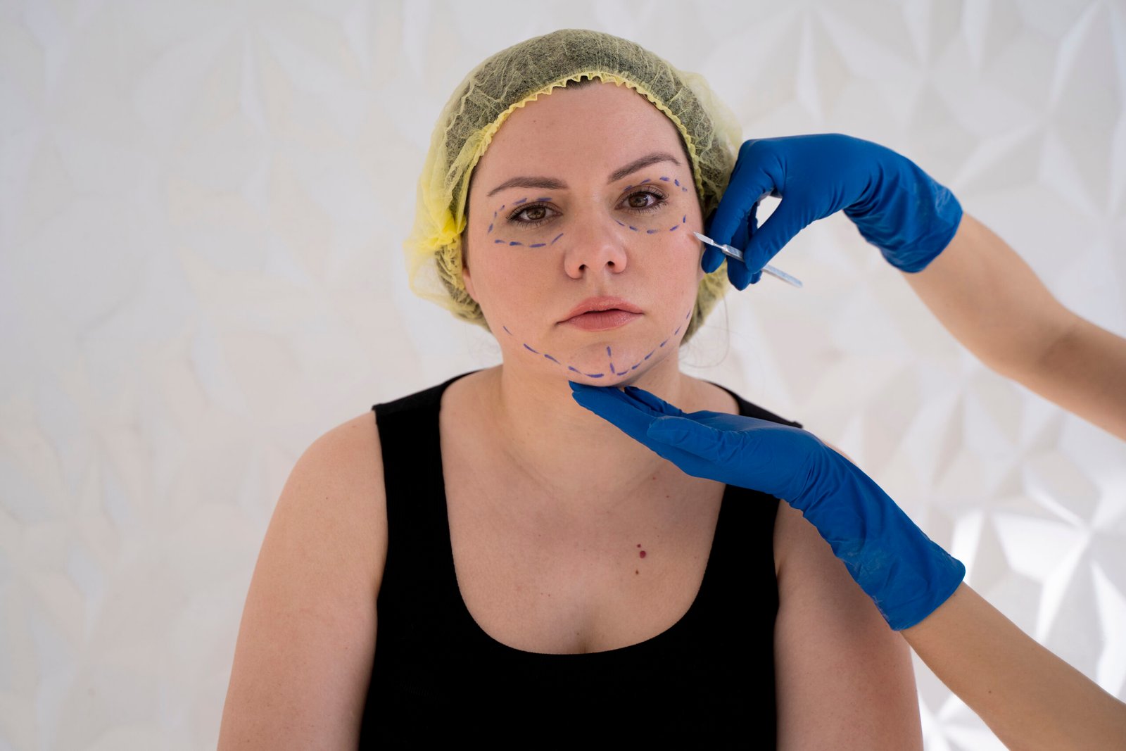 Procedimiento quirúrgico de lipotransferencia facial en Cayra Clinic