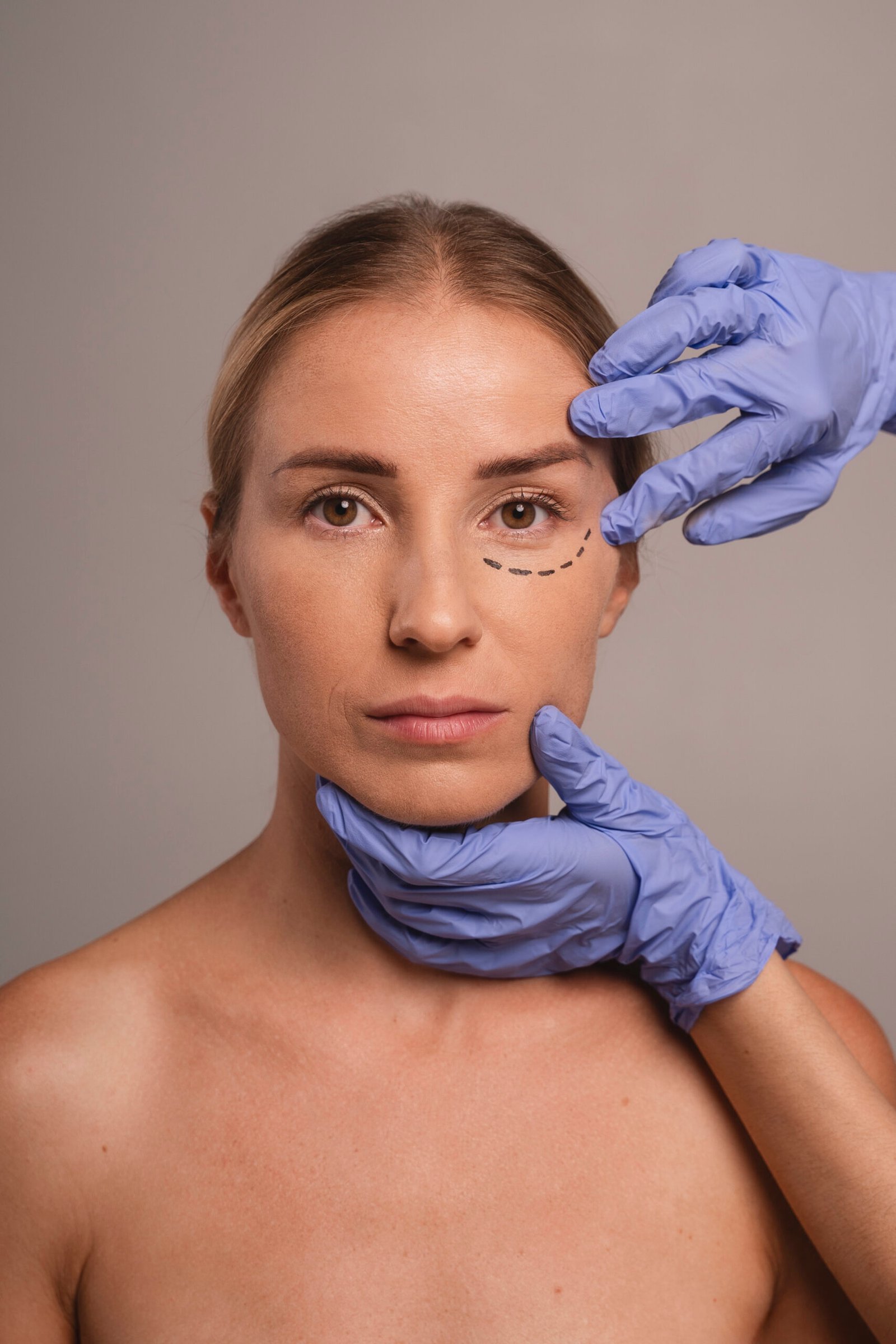 Equipamiento médico y microcirugía estéril para blefaroplastia inferior en Turquía