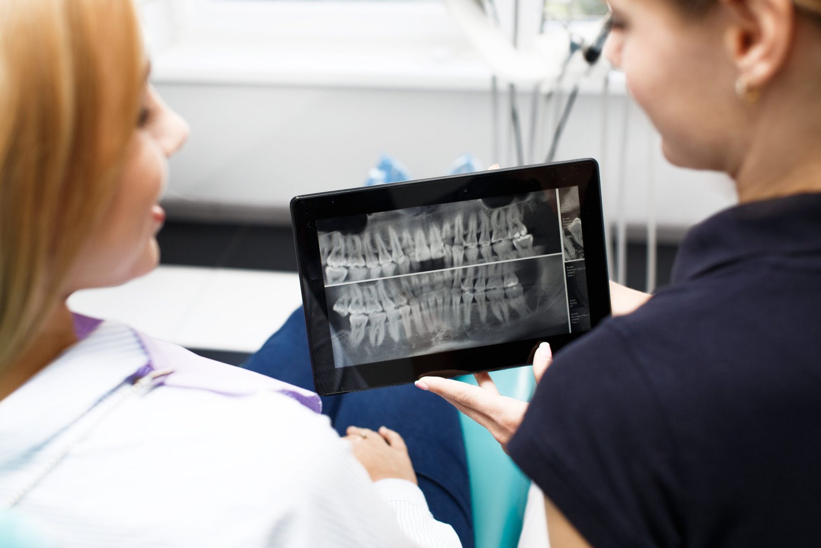 Tecnología avanzada y planificación digital para revisión de implantes en Turquía