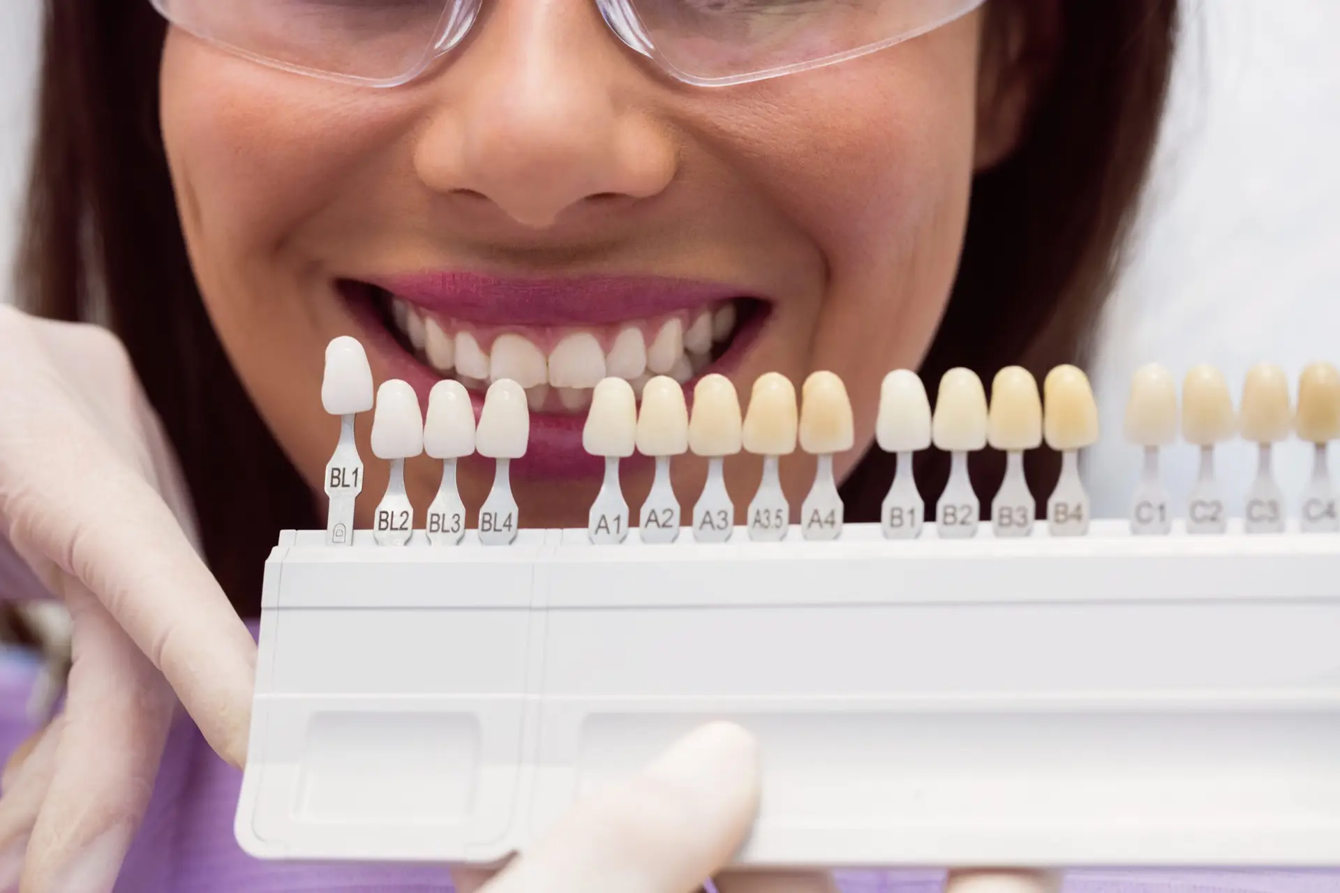 Estudio de la linea de sonrisa y proporcion dental para definir el numero exacto de carillas