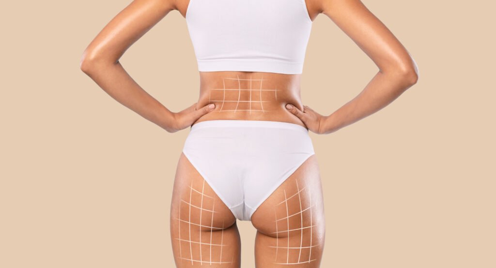 Guia completa sobre lipo 360 y bbl en turquia con precio combinado y dias de estancia en antalya