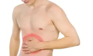 Guia medica exhaustiva sobre manga gastrica con reflujo o hernia de hiato en turquia analizando cuando es mejor el bypass