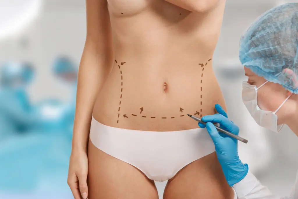 Guia medica exhaustiva sobre mini abdominoplastia en turquia cuando basta frente a la abdominoplastia completa