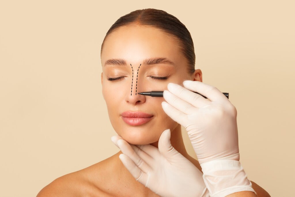 Resultado natural y estético de rinoplastia realizada por especialistas en Antalya
